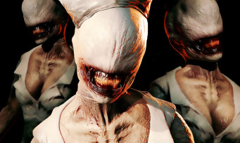 Bloober Team : le studio va présenter son nouveau jeu, l'heure du remake de Silent Hill 2 est-elle venue ?