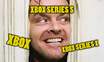 Xbox Series X : Microsoft est-il en train de s'emmêler les pinceaux comme Nintendo avec la Wii U ?