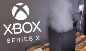 Xbox Series X: a smoking machine?  Microsoft responds