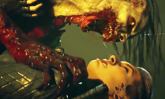 Back 4 Blood : un trailer de lancement avec des monstres bien dégueu