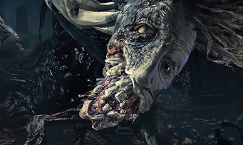 Bloodborne The Old Hunters : pour accéder à l'extension, méfiez-vous du New Game + !