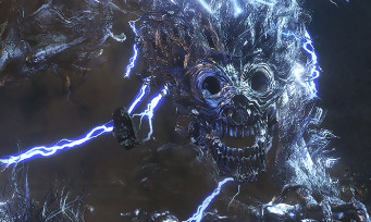 Bloodborne : découvrez le combat face au Darkbeast, le boss électrique