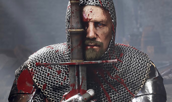 Chivalry 2 : le studio Torn Banner repousse le jeu à 2021 à cause du COVID