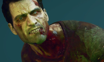 Dead Rising 4 : un DLC avec Frank West en mort-vivant