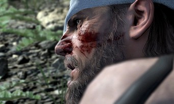 Metal Gear Solid 5 The Phantom Pain : des images de Big Boss en mauvaise posture