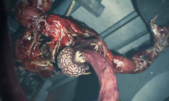 Resident Evil 2 : une nouvelle vidéo de gameplay avec les Lickers, ils font vraiment flipper