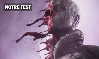 Test SCORN : une aventure horrifique qui prend littéralement aux tripes