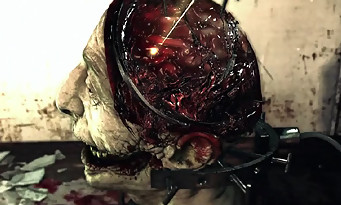 The Evil Within : de nouvelles images bien dégueulasses